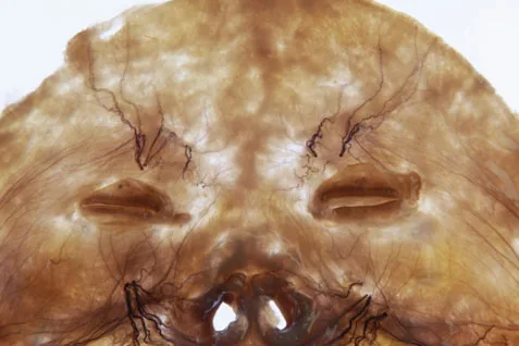 Fig 14. Frontal nerve filaments in a transilluminated specimen
